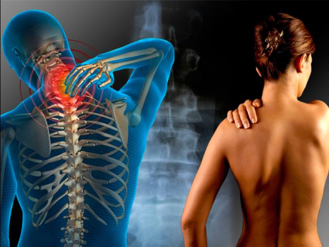 dolor espalda ifit