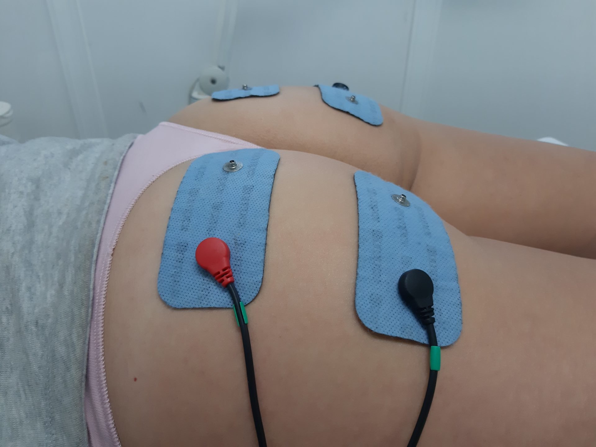 Electroestimulación muscular en Vigo